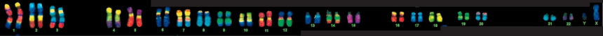 Stained Chromosomes